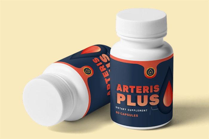 Arteris PlusArteris Plus